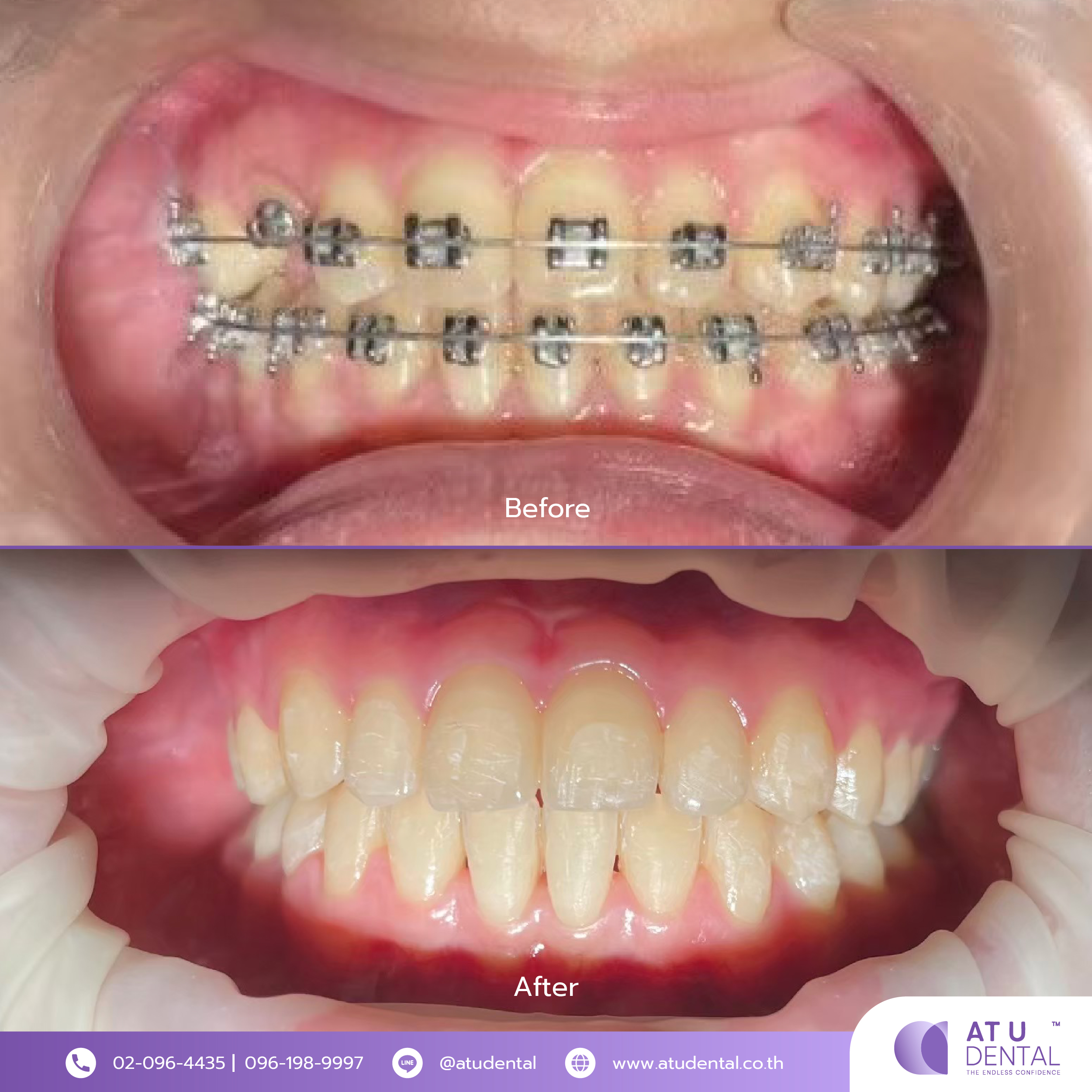 รีวิว 7