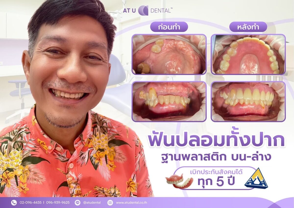 สิทธิ